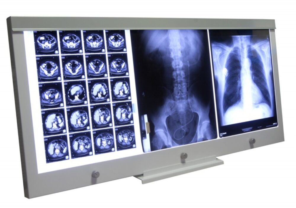 Negatoskop